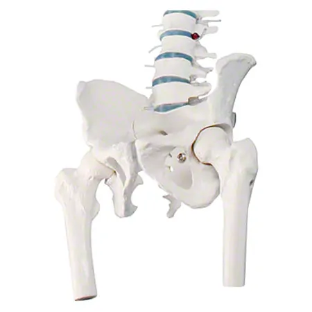 Spinal column with a disc prolapse incl. stand, 80 cm