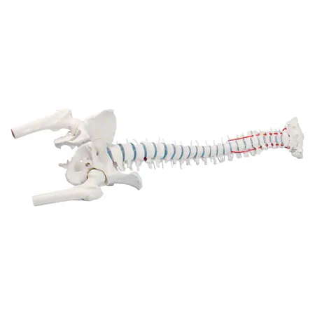 Spinal column with a disc prolapse incl. stand, 80 cm