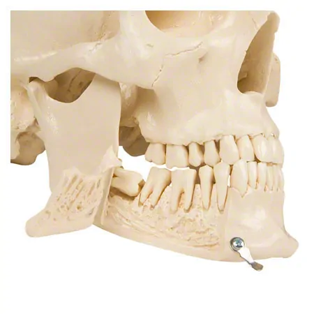 Skull, 4-piece.