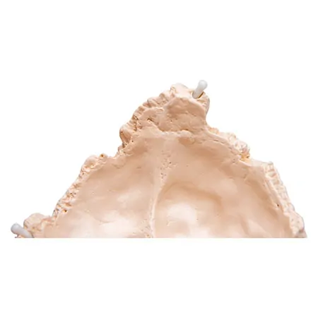 Snap skull, 18-piece, white