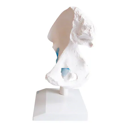 Hip joint, L x W x H 17 x 17 x 23 cm