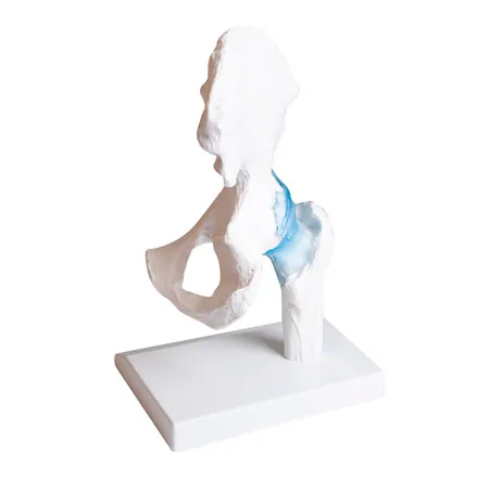 Hip joint, L x W x H 17 x 17 x 23 cm