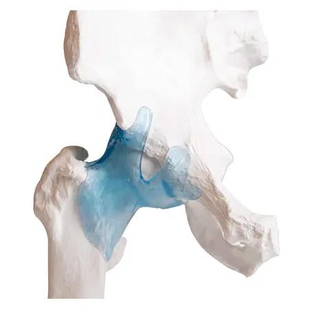 Hip joint, L x W x H 17 x 17 x 23 cm