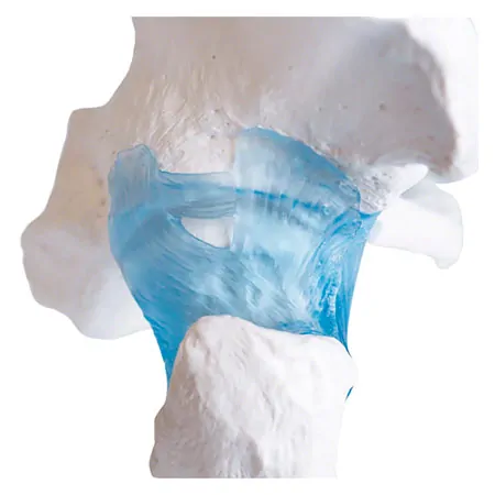 Hip joint, L x W x H 17 x 17 x 23 cm