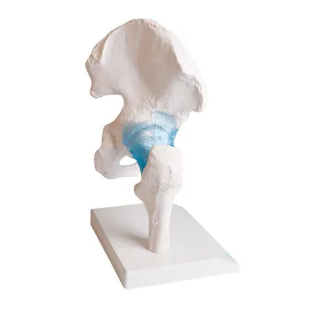 Hip joint, L x W x H 17 x 17 x 23 cm