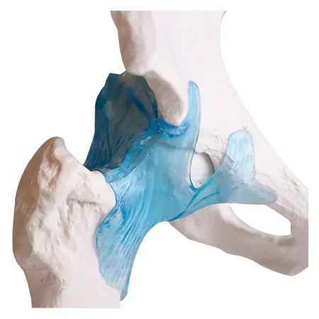 Hip joint, L x W x H 17 x 17 x 23 cm