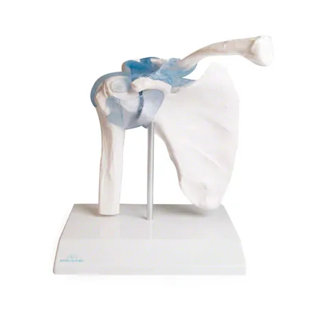 shoulder joint, L x B x H 16 x 13 x 18,5 cm