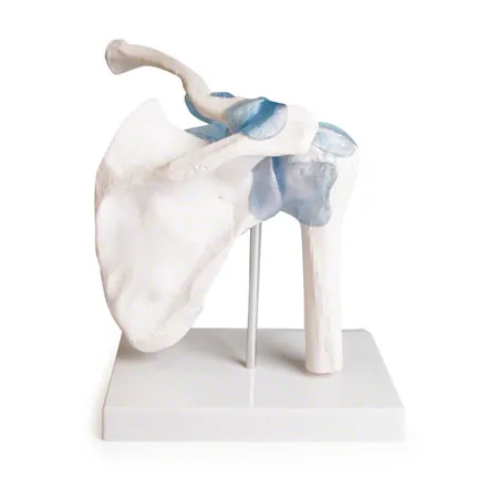 shoulder joint, L x B x H 16 x 13 x 18,5 cm
