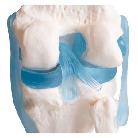 Knee joint, LxWxH 13x13x40 cm