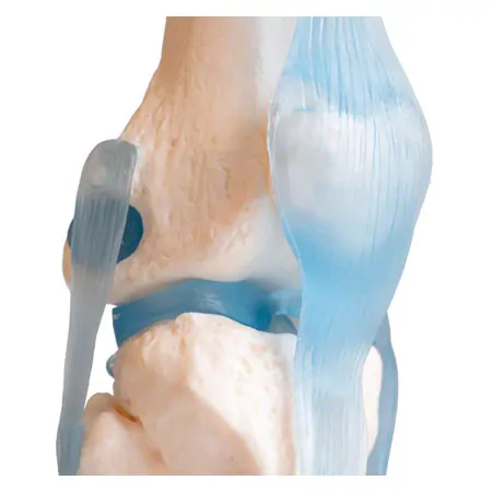 Knee joint, LxWxH 13x13x40 cm