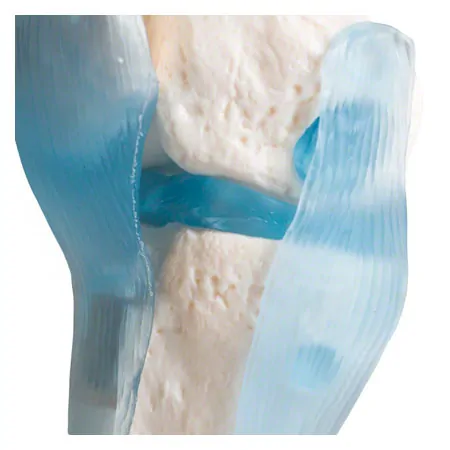 Knee joint, LxWxH 13x13x40 cm