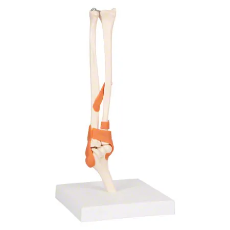 Elbow joint, LxWxH 13x13x37 cm