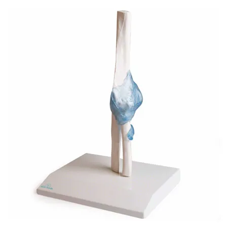 Elbow joint, LxWxH 28,5x16,5x14,5 cm