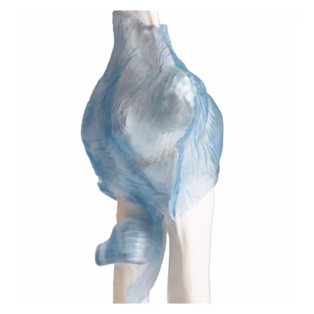 Elbow joint, LxWxH 28,5x16,5x14,5 cm