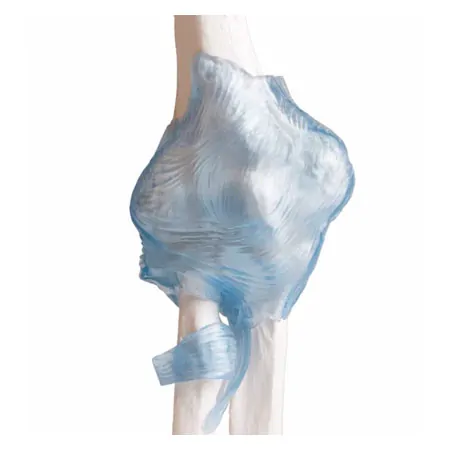 Elbow joint, LxWxH 28,5x16,5x14,5 cm