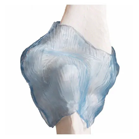 Elbow joint, LxWxH 28,5x16,5x14,5 cm