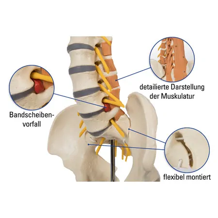 Pelvis with lumbar spine and lumbar muscles, LxHxB 39x26x21 cm