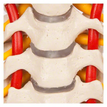 Cervical spine, LxWxH 19x19x25 cm