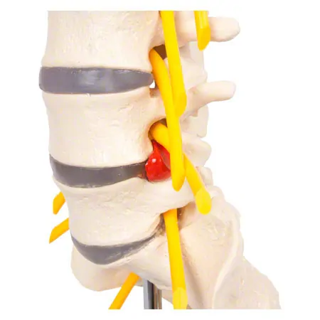 Lumbar spine, LxWxH 19x19x27 cm