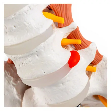 Male pelvis with lumbar spine and lumbar muscles