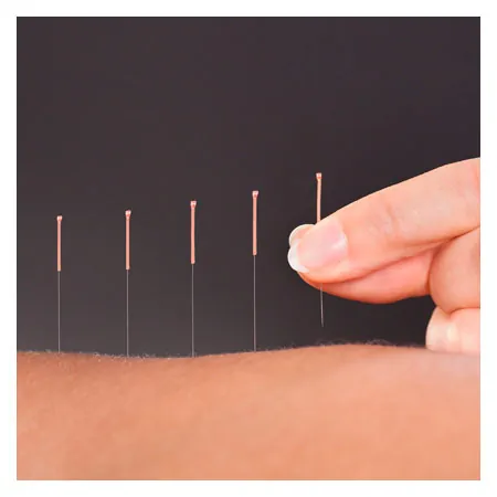 Acupuncture needles with copper spiral handle, 0.20x15 mm