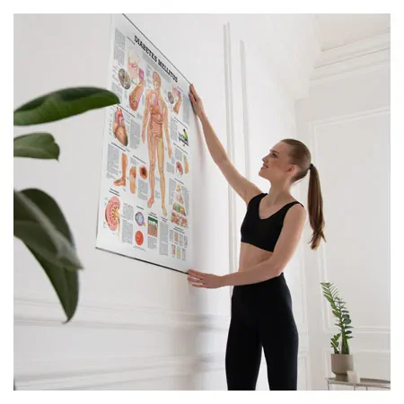 Wall chart - Diabetes Mellitus -, LxW 100x70 cm