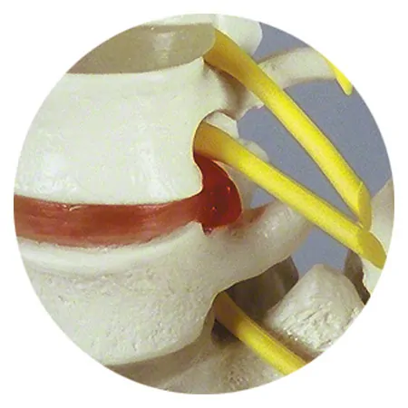Anatomy set: skull 4-pcs. and spine with herniated disk