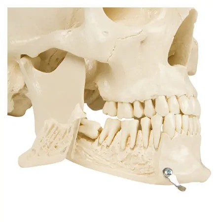 Anatomy set: skull 4-pcs. and spine with herniated disk