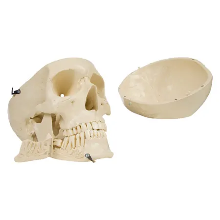Anatomy set: skull 4-pcs. and spine with herniated disk
