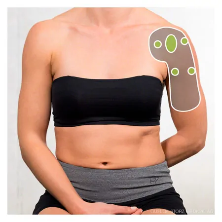 STORZ MEDICAL shock wave therapy device MASTERPULS ONE