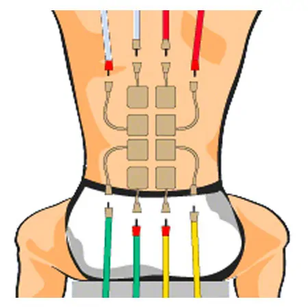 Compex electrodes wire, 5x5 cm, 4 pieces