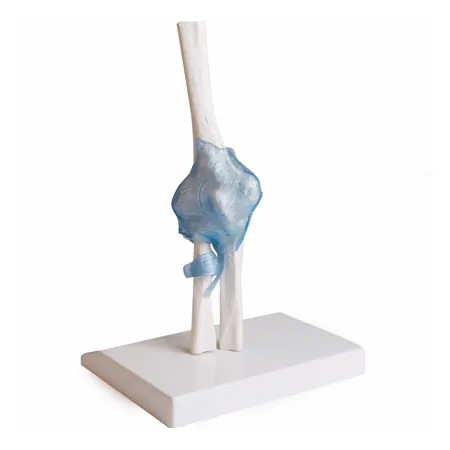 Elbow joint, LxWxH 28,5x16,5x14,5 cm