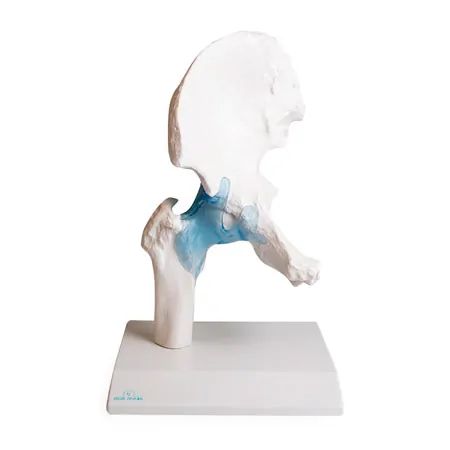 Hip joint, L x W x H 17 x 17 x 23 cm
