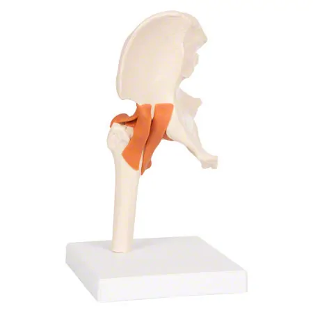 Hip joint, LxWxH 17x17x23 cm