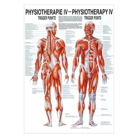 Poster - trigger points - L x W 70x50 cm