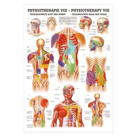 Poster - trigger points head and torso - L x W 70x50 cm
