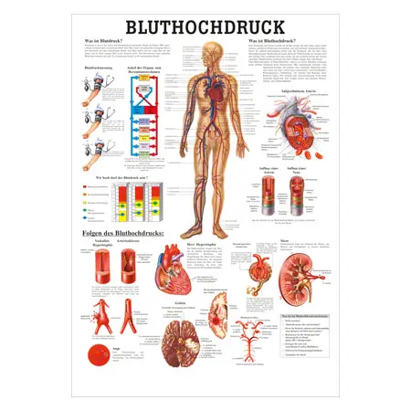 Posters - high blood pressure - , LxW 70x50 cm