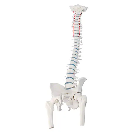 Spinal column with a disc prolapse incl. stand, 80 cm