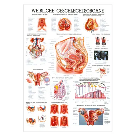 Wall chart - Female Reproductive System - , LxW 100x70 cm