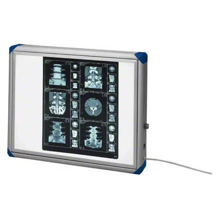 X-ray film viewer 560 Mediskop, blue corners