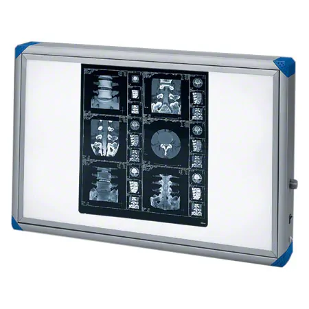 X-ray film viewer 860 Mediskop, blue corners