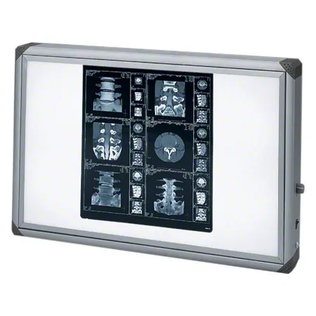 X-ray film viewer 860 Mediskop, gray corners