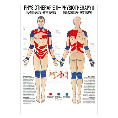Posters - thermotherapy - L x W 70x50 cm