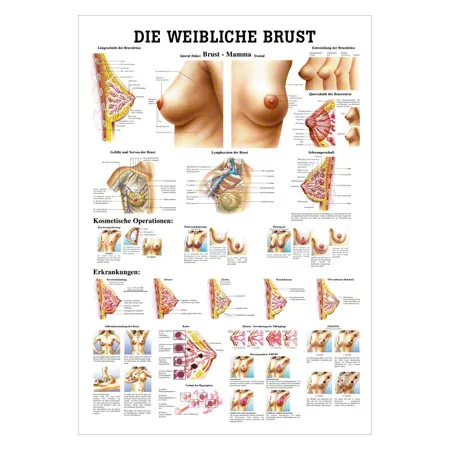Wall chart - Female breast - LxW 100x70 cm