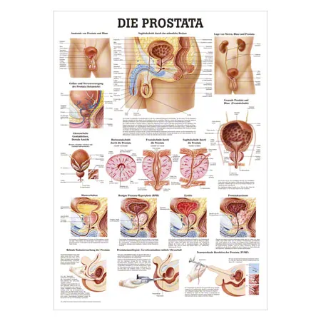 Wall chart - The Prostate - LxW 100x70 cm