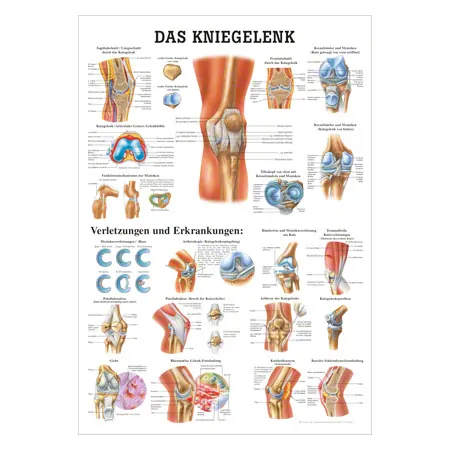 Wall chart - The knee joint - L x 100x70 cm