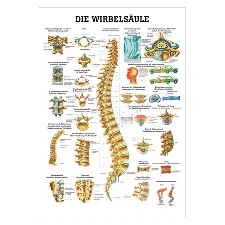 Wall chart - The spinal column - , LxW 100x70 cm