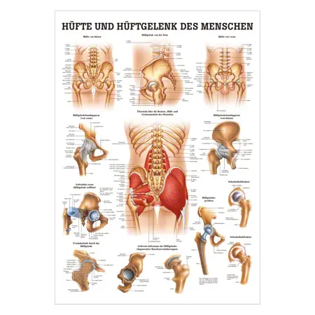 Wall chart - hip and hip joint - , LxW 100x70 cm
